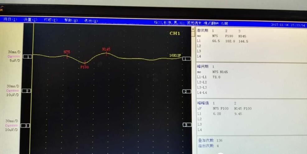 脑部神经电生理检查技术的发展和优势